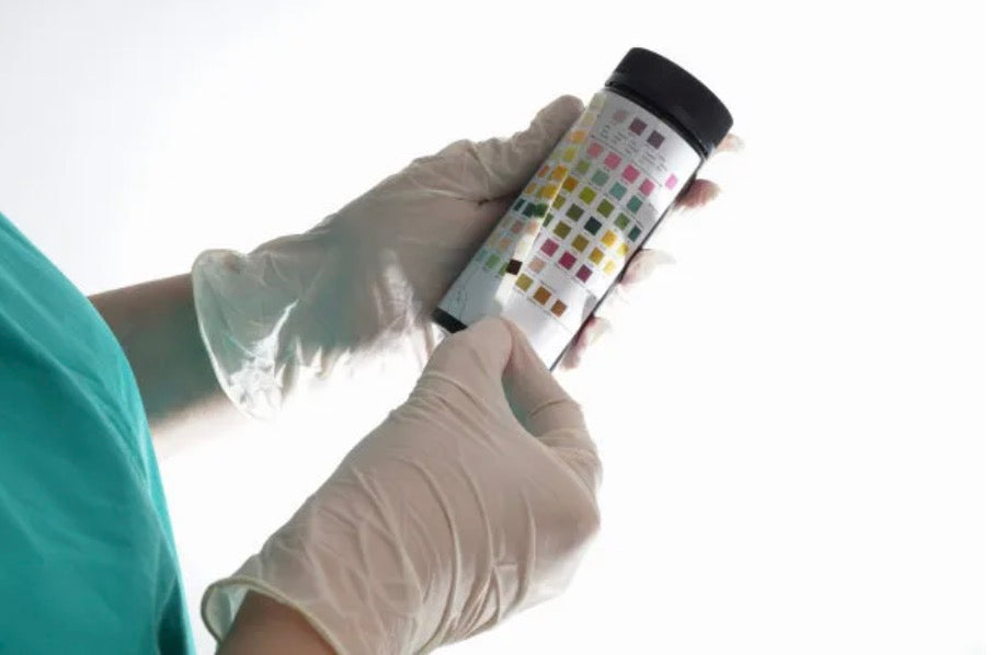 Advantages of At-Home Urinalysis Testing
