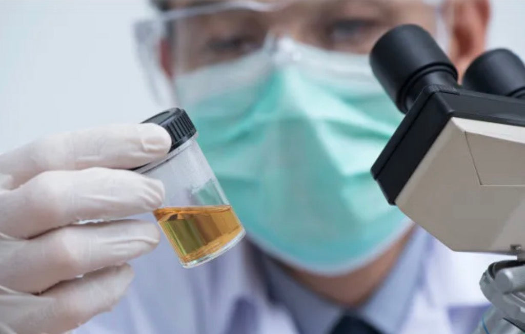 Some Important Information About Urinalysis